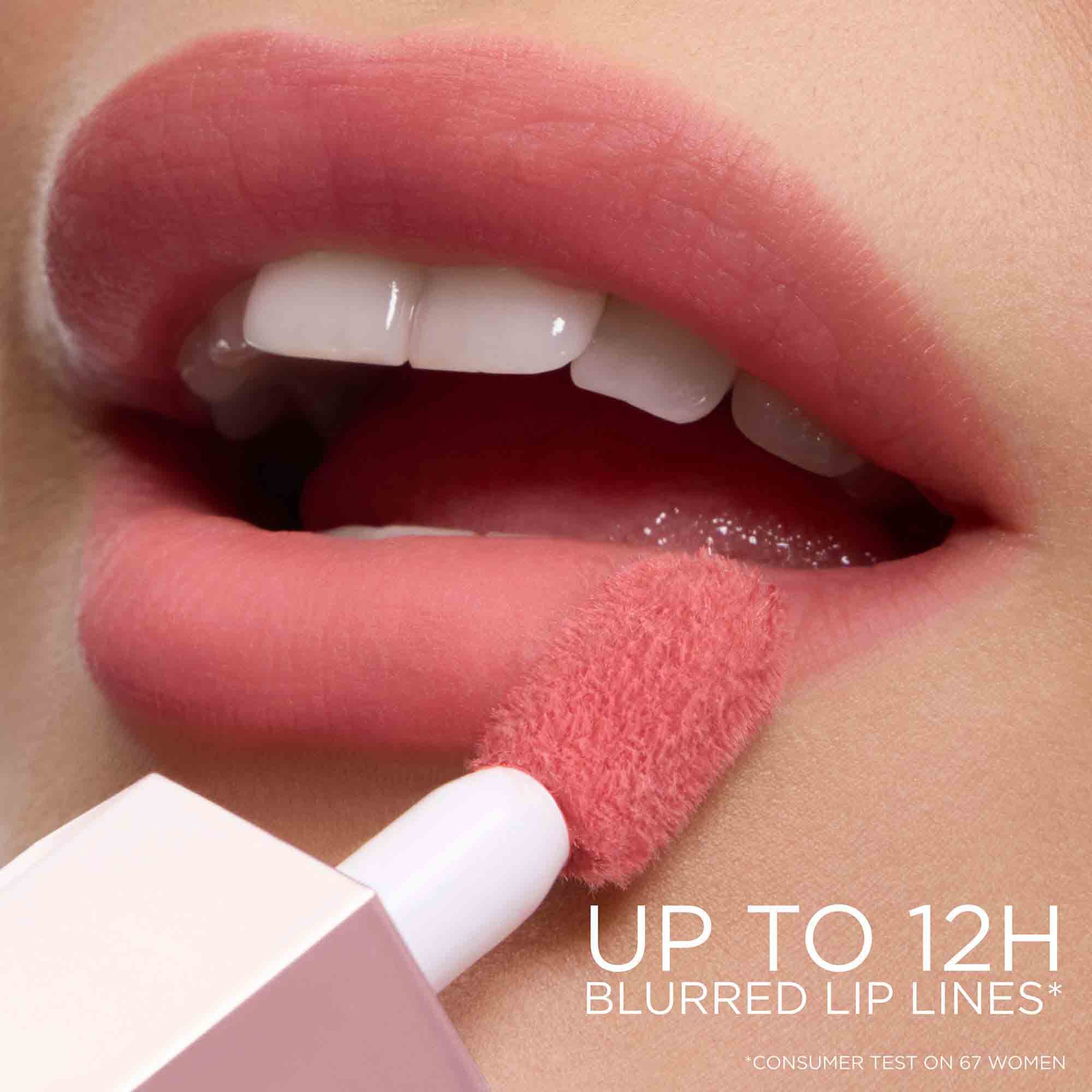 Close-up of the lips
