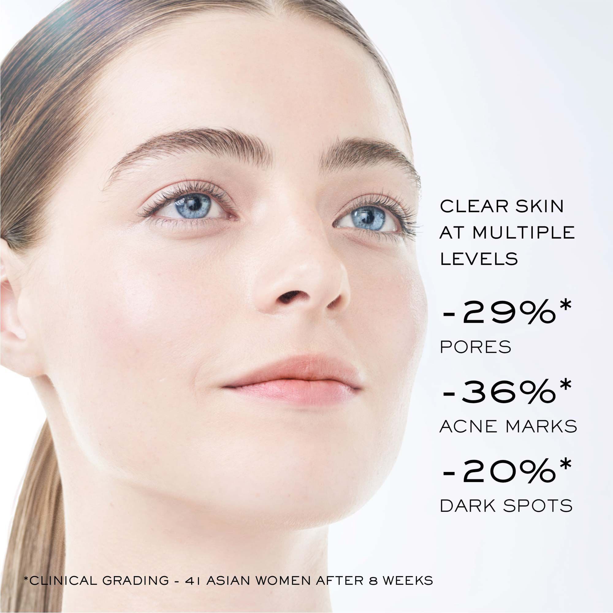 Close-up of a model  highlighting reductions in pores, acne marks, and dark spots from clinical results after using Lancome Clarifique Pro-Solution Serum.