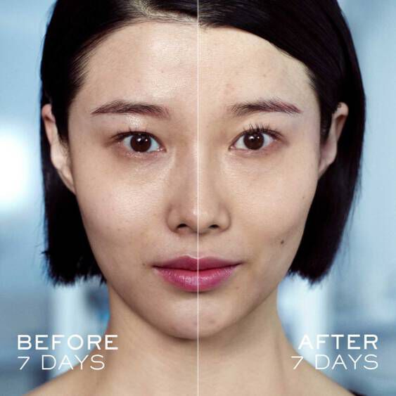ADVANCED GENIFIQUE SERUM
